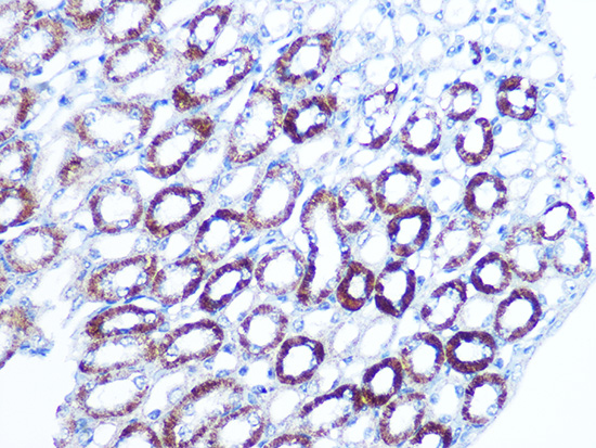 BAG3 Rabbit monoclonal antibody