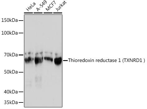 Human Thioredoxin Reductase 1/TRXR1 Rabbit monoclonal antibody