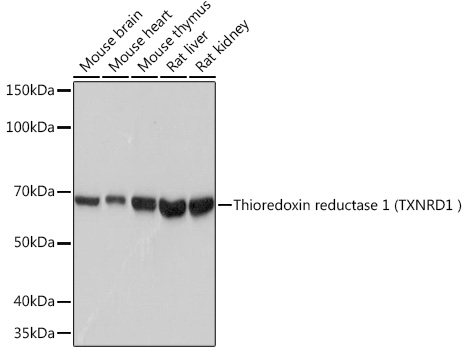 Human Thioredoxin Reductase 1/TRXR1 Rabbit monoclonal antibody