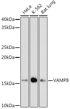 VAMP8 Rabbit monoclonal antibody