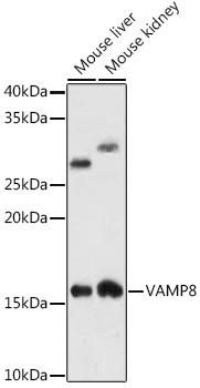 VAMP8 Rabbit monoclonal antibody