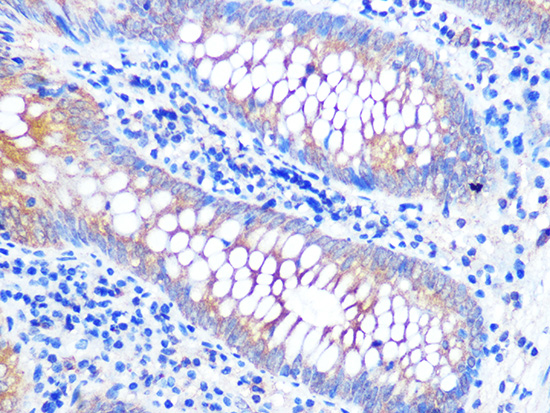 VAMP8 Rabbit monoclonal antibody