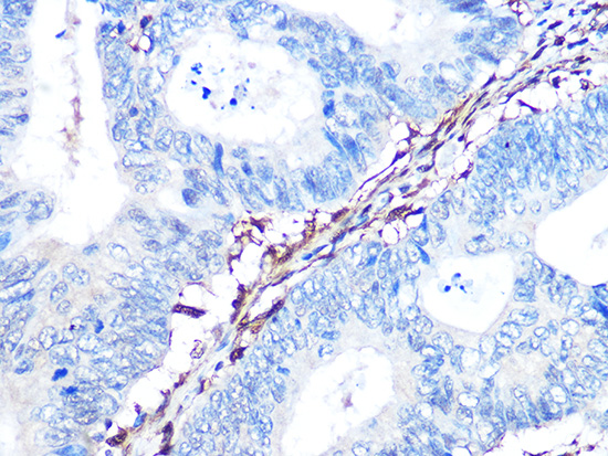 Galectin 1/LGALS1 Rabbit monoclonal antibody