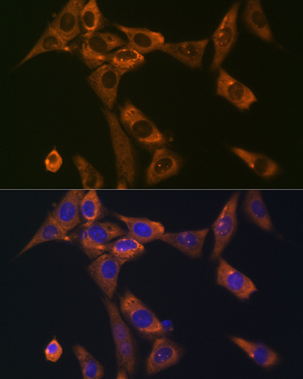 Galectin 1/LGALS1 Rabbit monoclonal antibody