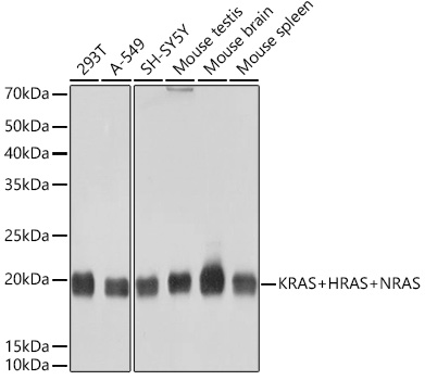 KRAS+HRAS+NRAS Rabbit monoclonal antibody