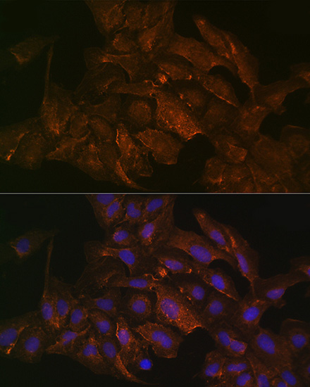 KRAS+HRAS+NRAS Rabbit monoclonal antibody