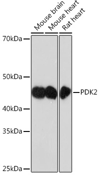 PDK2 Rabbit monoclonal antibody