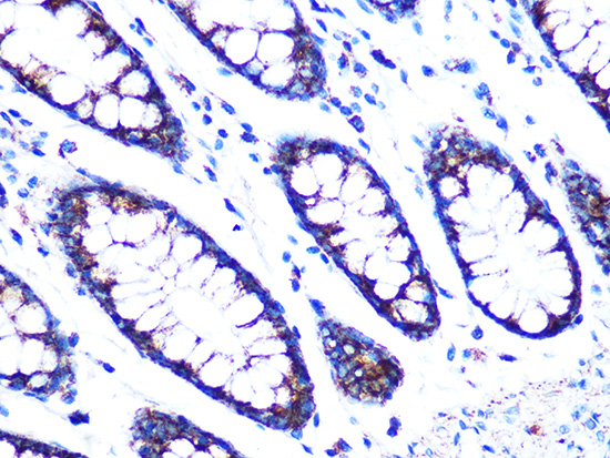 PDK2 Rabbit monoclonal antibody