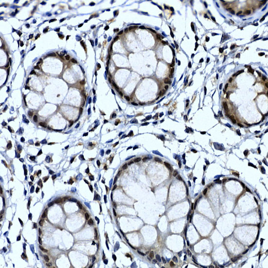 NELFCD Rabbit polyclonal antibody