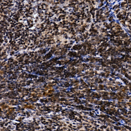 NELFCD Rabbit polyclonal antibody