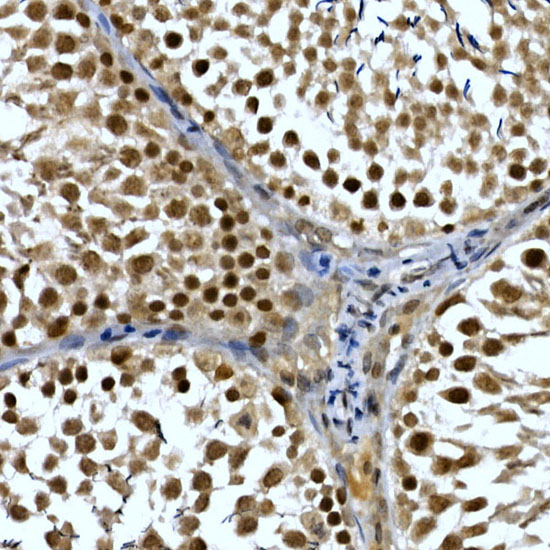 NELFCD Rabbit polyclonal antibody