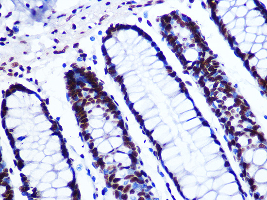 GTPBP4 Rabbit monoclonal antibody