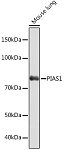 Western blot - PIAS1 Rabbit mAb (A4744)