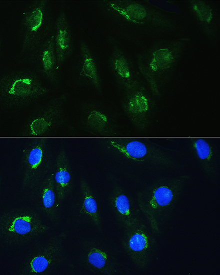 NBAS Rabbit polyclonal antibody