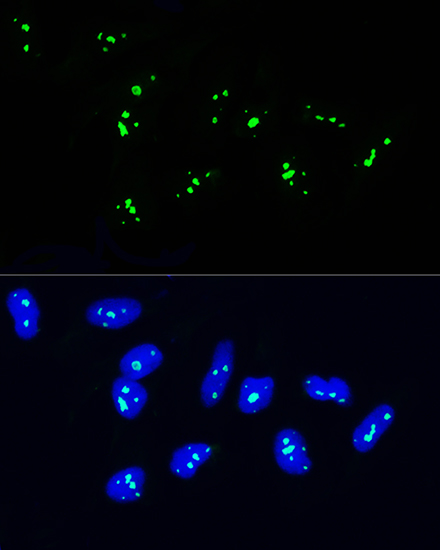 NOP58 Rabbit polyclonal antibody