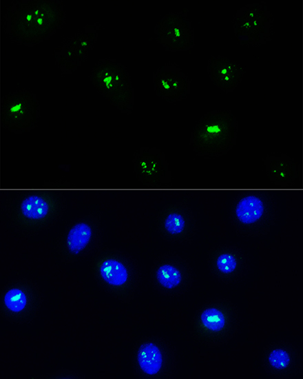 NOP58 Rabbit polyclonal antibody