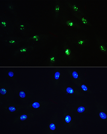 NOP58 Rabbit polyclonal antibody