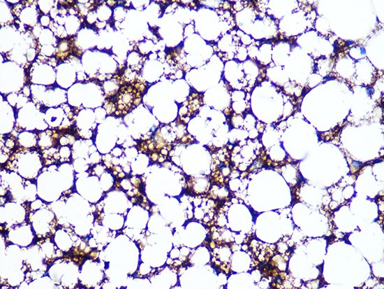Perilipin A Rabbit monoclonal antibody