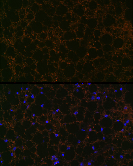 Perilipin A Rabbit monoclonal antibody