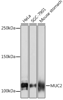 MUC2 Rabbit monoclonal antibody