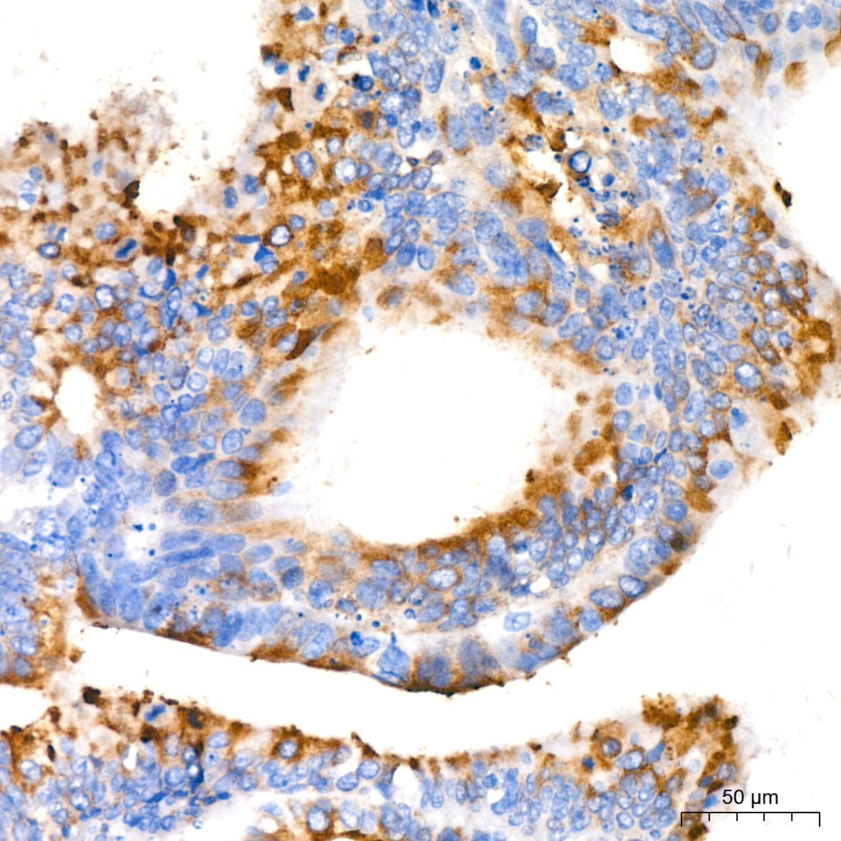 MUC2 Rabbit monoclonal antibody