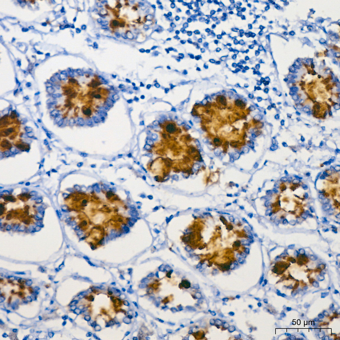 MUC2 Rabbit monoclonal antibody