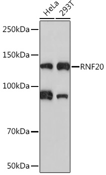 RNF20 Rabbit monoclonal antibody