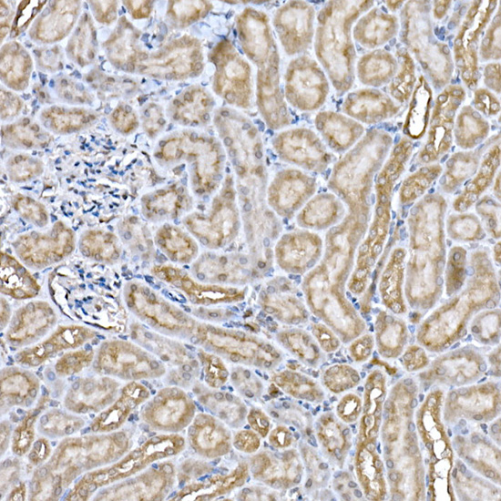 Niemann Pick C1 Rabbit monoclonal antibody