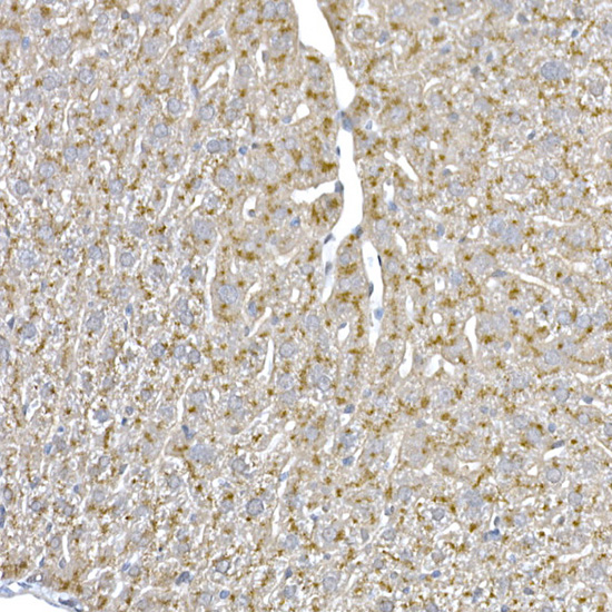 Niemann Pick C1 Rabbit monoclonal antibody