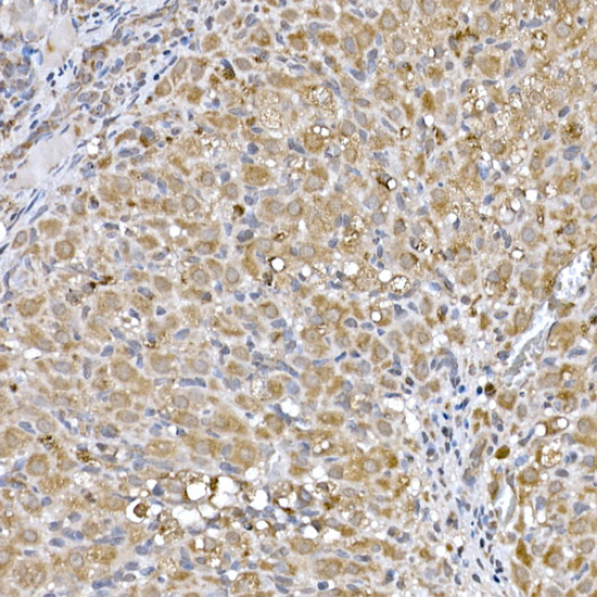 Niemann Pick C1 Rabbit monoclonal antibody