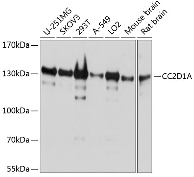 CC2D1A Rabbit polyclonal antibody