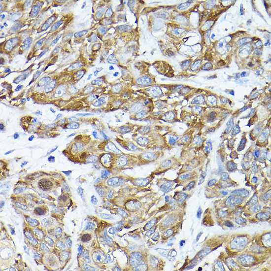 CC2D1A Rabbit polyclonal antibody