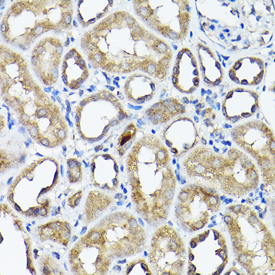 CC2D1A Rabbit polyclonal antibody