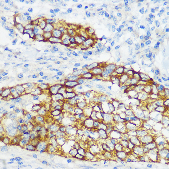 Collagen XVII/COL17A1 Rabbit monoclonal antibody