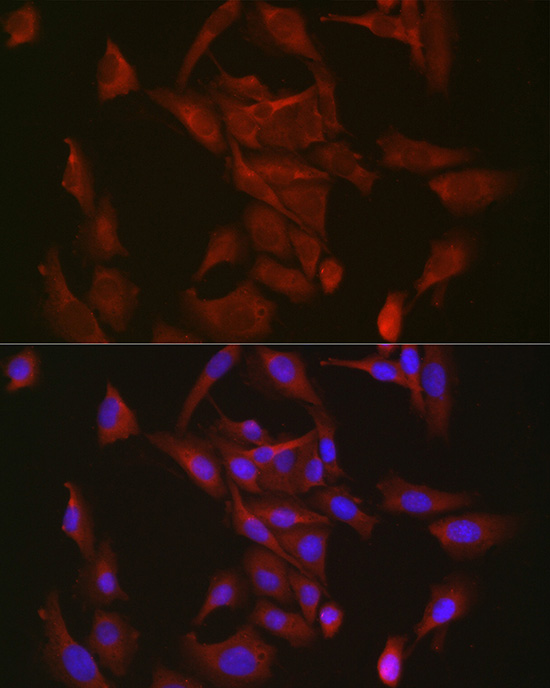 Aconitase 1 (ACO1) Rabbit monoclonal antibody
