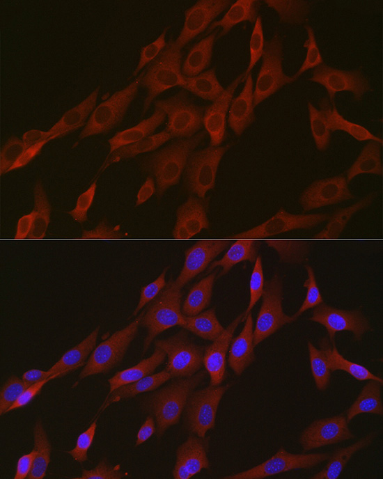 Aconitase 1 (ACO1) Rabbit monoclonal antibody