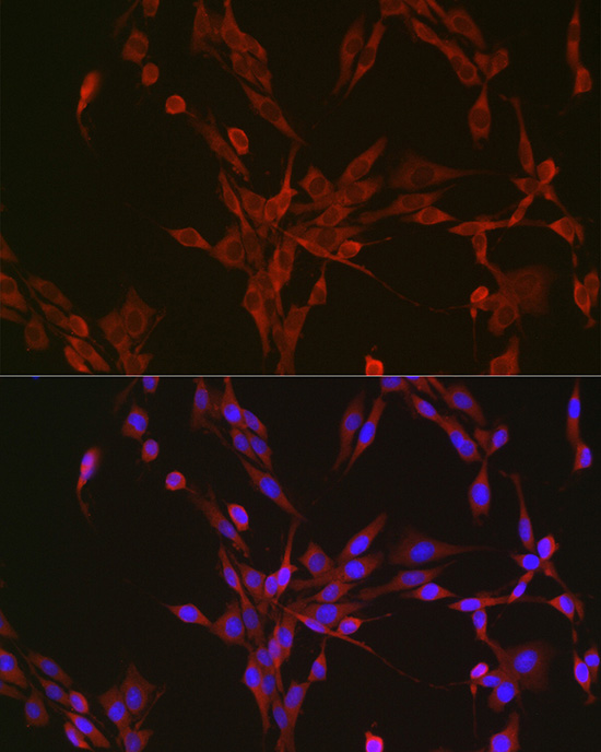 Aconitase 1 (ACO1) Rabbit monoclonal antibody