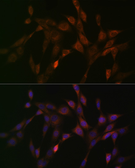 DNAJC15 Rabbit monoclonal antibody