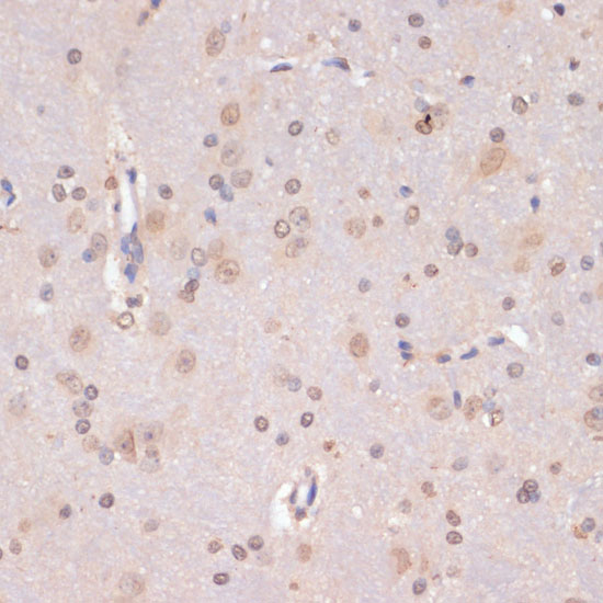 PIDD Rabbit polyclonal antibody