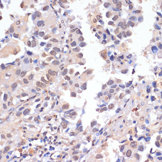 PIDD Rabbit polyclonal antibody