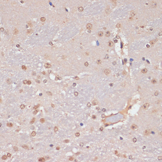PIDD Rabbit polyclonal antibody