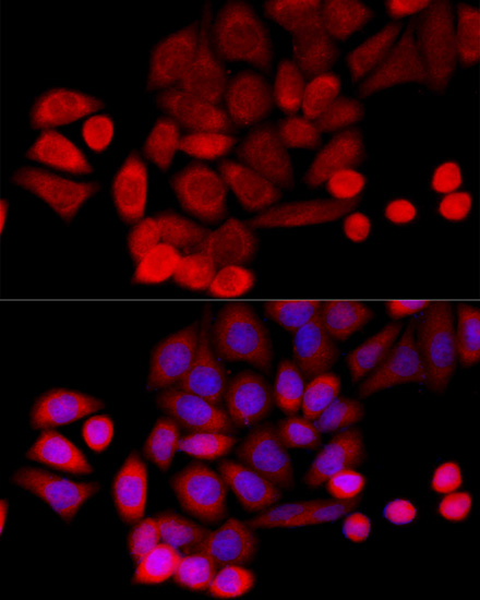 PIDD Rabbit polyclonal antibody