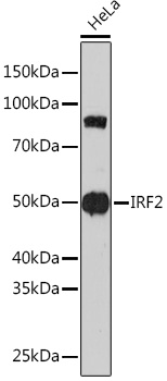 IRF2 Rabbit monoclonal antibody