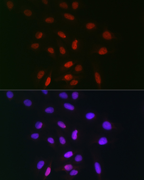 TDP1 Rabbit polyclonal antibody