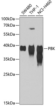 SPK Rabbit polyclonal antibody