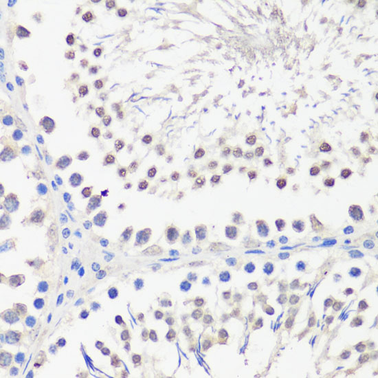 SPK Rabbit polyclonal antibody