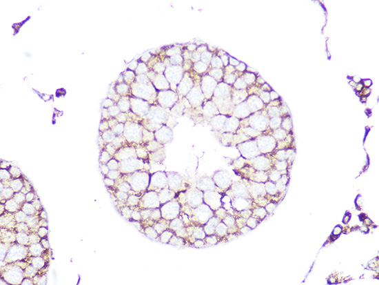 RHOA/RHOB/RHOC Rabbit monoclonal antibody