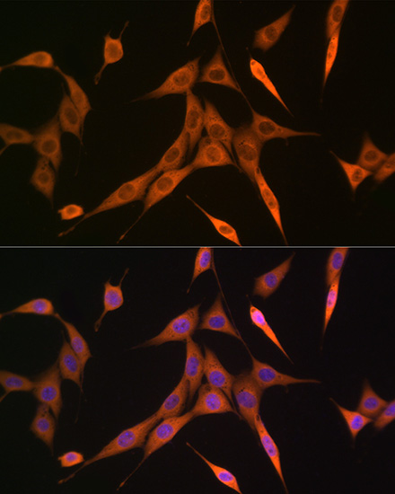 RHOA/RHOB/RHOC Rabbit monoclonal antibody