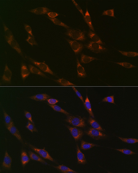 RPS3 Rabbit monoclonal antibody