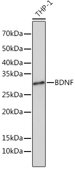 BDNF Rabbit monoclonal antibody